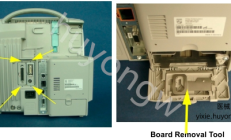 飞利浦MP50监护仪移除IO板
