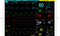 迈瑞pm7000监护仪上的图解之屏幕显示详解
