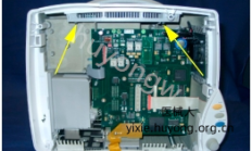 飞利浦MP50监护仪移除提手