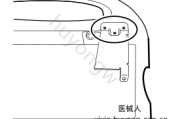 伟伦VSM6000监护仪移除灯管