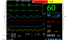 mindray监护仪imec10的屏幕介绍