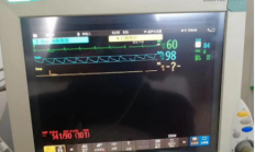 飞利浦mp60模块无法测量血压是什么原因？