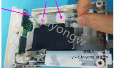 迈瑞N1监护仪移除NIBP模块