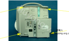 飞利浦MP50监护仪分离前壳和后壳