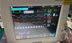 飞利浦监护仪mp30拆解步骤